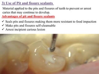 3) Use of Pit and fissure sealants
Material applied to the pits and fissures of teeth to prevent or arrest
caries that may continue to develop.
Advantages of pit and fissure sealants
 Seals pits and fissures making them more resistant to food impaction
 Make pits and fissures self-cleansable
 Arrest incipient carious lesion
 