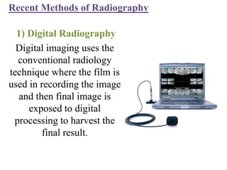 Digital imaging uses the
conventional radiology
technique where the film is
used in recording the image
and then final image is
exposed to digital
processing to harvest the
final result.
Recent Methods of Radiography
1) Digital Radiography
 