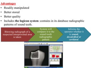 Advantages
• Readily manipulated
• Better stored
• Better quality
• Includes the logicon system :contains in its database radiographic
patterns of sound teeth.
Bitewing radiograph of a
suspected interproximal area
is taken
System will
compare it to the
sound tooth
radiographic
pattern
Informs the
operator whether it
is sound,
decalcified or
cavitated.
 
