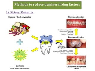 Methods to reduce demineralizing factors
1) Dietary Measures
 