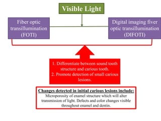 Changes detected in initial carious lesions include:
Microporosity of enamel structure which will alter
transmission of light. Defects and color changes visible
throughout enamel and dentin.
Visible Light
Fiber optic
transillumination
(FOTI)
Digital imaging fiver
optic transillumination
(DIFOTI)
1. Differentiate between sound tooth
structure and carious tooth.
2. Promote detection of small carious
lesions.
 