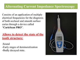 Alternating Current Impedance Spectroscopy
Consists of an application of multiple
electrical frequencies for the diagnosis
of both occlusal and smooth surface
caries through a device called
“CarieScan PRO”.
Allows to detect the state of the
tooth structure:
-Sound
-Early stages of demineralization
-Badly decayed state.
 