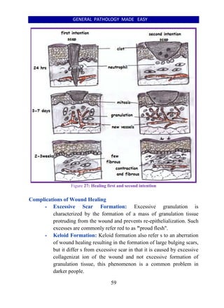 GENERAL PATHOLOGY MADE EASY
59
Figure 27: Healing first and second intention
Complications of Wound Healing
- Excessive Scar Formation: Excessive granulation is
characterized by the formation of a mass of granulation tissue
protruding from the wound and prevents re-epithelialization. Such
excesses are commonly refer red to as "proud flesh".
- Keloid Formation: Keloid formation also refer s to an aberration
of wound healing resulting in the formation of large bulging scars,
but it differ s from excessive scar in that it is caused by excessive
collagenizat ion of the wound and not excessive formation of
granulation tissue, this phenomenon is a common problem in
darker people.
 