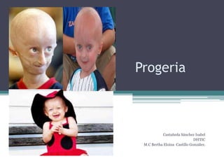 Progeria
Castañeda Sánchez Isabel
DHTIC
M.C Bertha Eloína Castillo González.
 