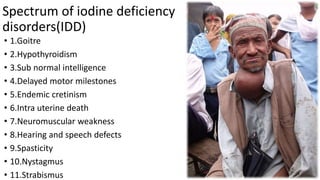 Iodine deficiency disorders | PPTX | Thyroid Disorders | Endocrine and ...