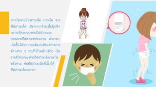 ภาวะไอจามปัสสาวะเล็ด ภาวะไอ จาม
ปัสสาวะเล็ด เกิดจากกล้ามเนืออุ้งเชิง
กรานที่คอยพยุงท่อปัสสาวะและ
กระเพาะปัสสาวะหย่อนยาน สามารถ
เกิดขึนได้จากภาวะผิดปกติของร่างกาย
ด้านต่าง ๆ รวมถึงโรคอ้วนด้วย เมื่อ
ขาดตัวช่วยพยุงท่อปัสสาวะเมื่อเวลาไอ
หรือจาม ท่อปัสสาวะเปิดตัวทาให้
ปัสสาวะเล็ดออกมา
 