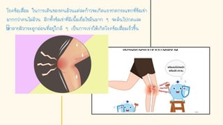 โรคข้อเสื่อม ในการเดินของคนอ้วนแต่ละก้าวจะเกิดเเรงกดกระแทกที่ข้อเข่า
มากกว่าคนไม่อ้วน อีกทังข้อเข่าที่มีเนือเยื่อไขมันมาก ๆ จะล้นไปกดเเละ
ทาลายผิวกระดูกอ่อนที่อยู่ใกล้ ๆ เป็นการเร่งให้เกิดโรคข้อเสื่อมเร็วขึน
 