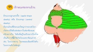 อ้วนแบบลูกแอปเปิ้ล (apple-shape
obesity) หรือ อ้วนลงพุง (central
obesity)
คือคนอ้วนที่มีรอบเอวใหญ่กว่ารอบสะโพก
เกิดจากมีไขมันสะสมมากในช่องท้องและ
อวัยวะภายใน ไขมันที่อยู่ในอวัยวะภายในนีจะ
เป็นตัวการที่ทาให้เกิดโรคแทรกซ้อนต่างๆ
เช่น โรคเบาหวาน โรคหลอดเลือดหัวใจตีบ
โรคความดันโลหิตสูง
11 ลักษณะของคนอ้วน
 