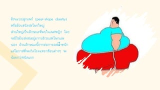 อ้วนแบบลูกแพร์ (pear-shape obesity)
หรืออ้วนชนิดสะโพกใหญ่
ส่วนใหญ่เป็นลักษณะที่พบในเพศหญิง โดย
จะมีไขมันสะสมอยู่มากบริเวณสะโพกและ
น่อง อ้วนลักษณะนียากต่อการลดนาหนัก
แต่โอกาสที่จะเกิดโรคแทรกซ้อนต่างๆ จะ
น้อยกว่าชนิดแรก
 