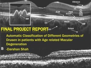 FINAL PROJECT REPORT
  Automatic Classification of Different Geometries of
  Drusen in patients with Age related Macular
  Degeneration
  -Darshan Shah
 