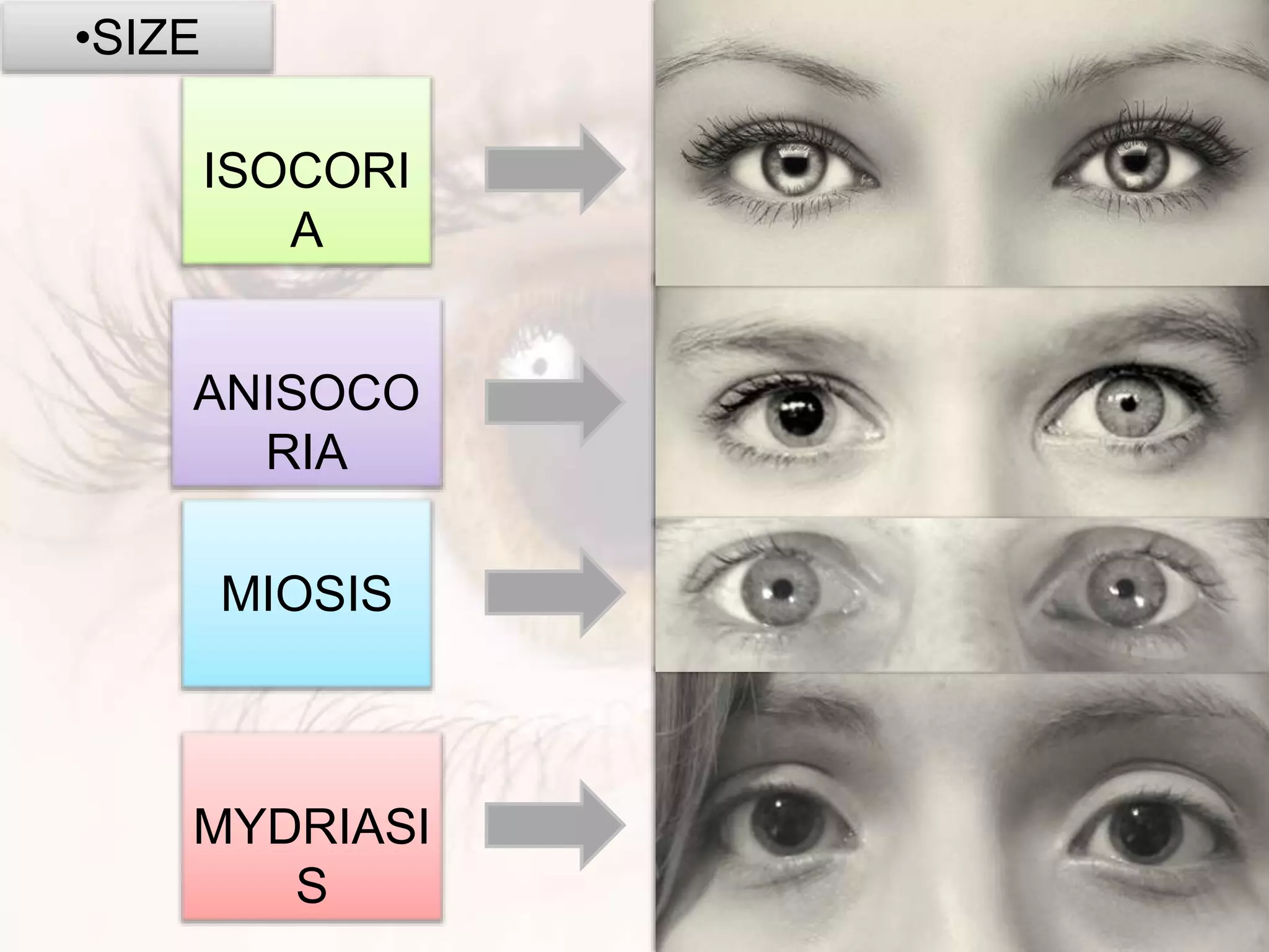 •SIZE
ISOCORI
A
ANISOCO
RIA
MIOSIS
MYDRIASI
S
 