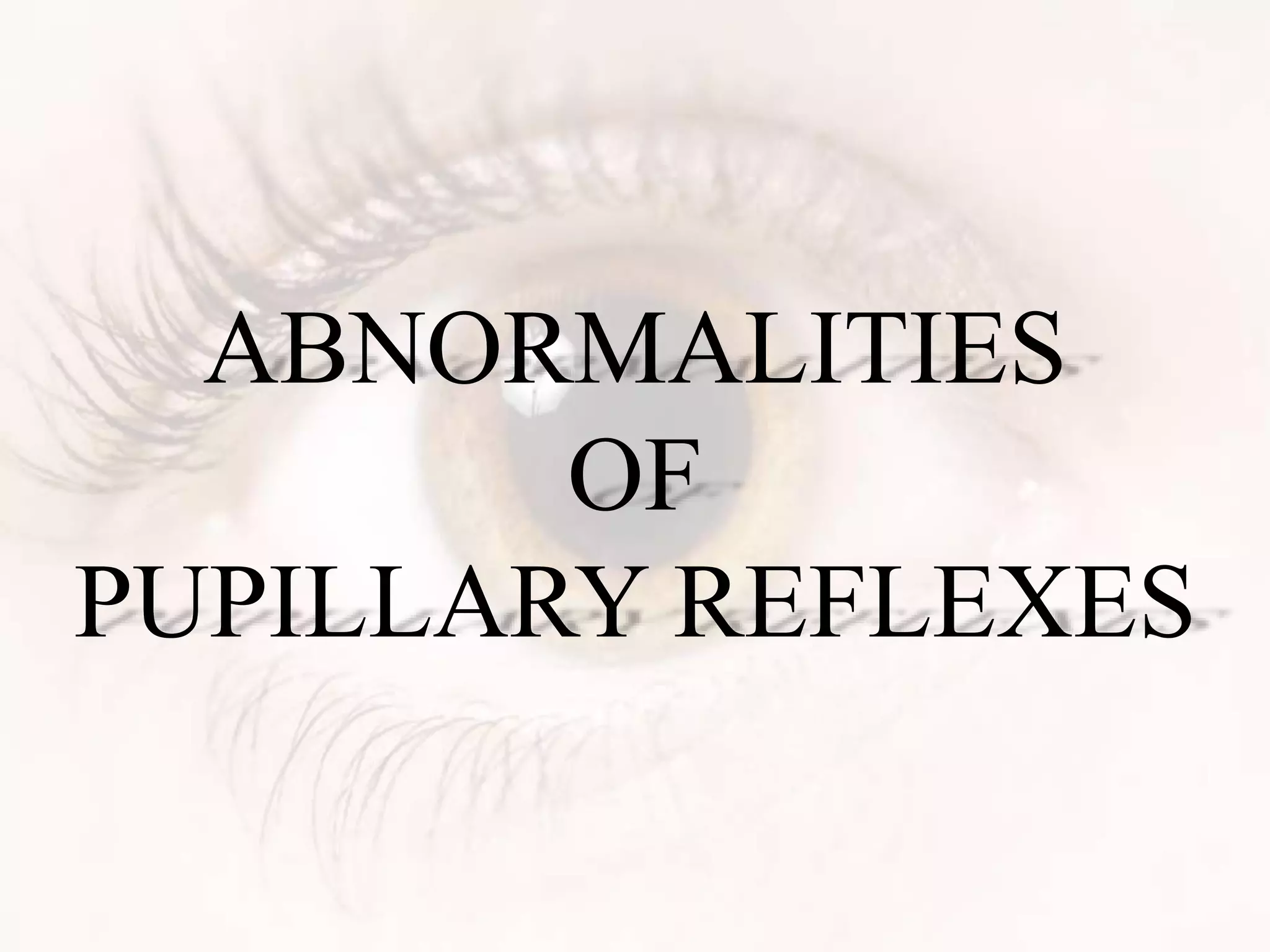 ABNORMALITIES
OF
PUPILLARY REFLEXES
 