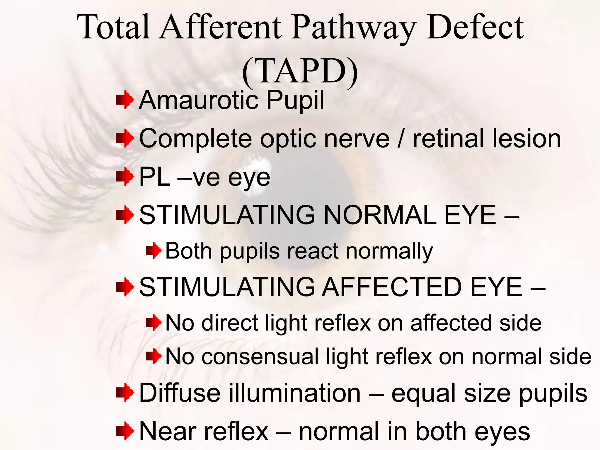 Total Afferent Pathway Defect
(TAPD)
Amaurotic Pupil
Complete optic nerve / retinal lesion
PL –ve eye
STIMULATING NORMAL EYE –
Both pupils react normally
STIMULATING AFFECTED EYE –
No direct light reflex on affected side
No consensual light reflex on normal side
Diffuse illumination – equal size pupils
Near reflex – normal in both eyes
 