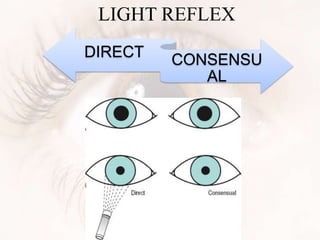 LIGHT REFLEX
DIRECT CONSENSU
AL
 