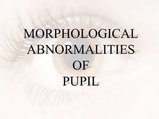 MORPHOLOGICAL
ABNORMALITIES
OF
PUPIL
 