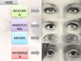 •SIZE
ISOCORI
A
ANISOCO
RIA
MIOSIS
MYDRIASI
S
 