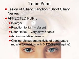 Tonic Pupil
Lesion of Ciliary Ganglion / Short Ciliary
Nerves
AFFECTED PUPIL
Is larger
Reaction to light – absent
Near Reflex – very slow & tonic
Accommodative paresis
Cholinergic supersensitivity of denervated
muscle (constricts with 0.125% pilocarpine)
 