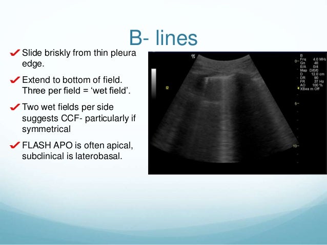 Lung Ultrasound - Final Quiz