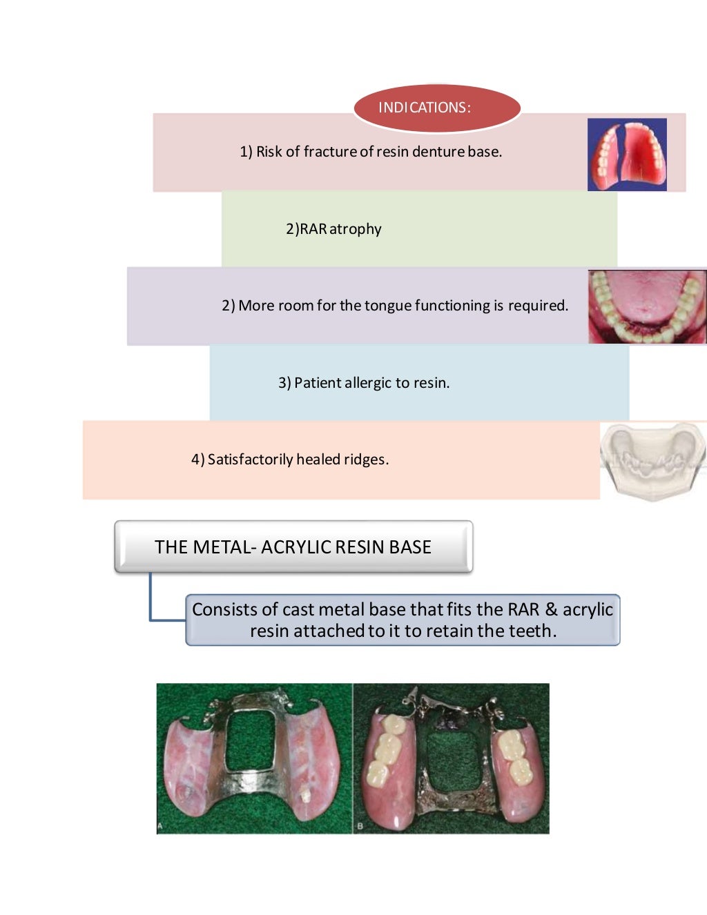 Materials used in Removable Partial Denture