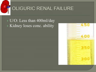  U/O: Less than 400ml/day
 Kidney loses conc. ability
 