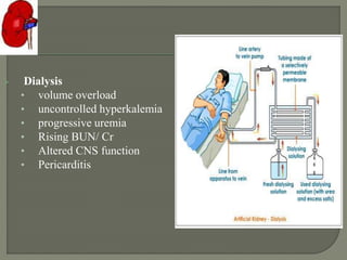  Dialysis
• volume overload
• uncontrolled hyperkalemia
• progressive uremia
• Rising BUN/ Cr
• Altered CNS function
• Pericarditis
 