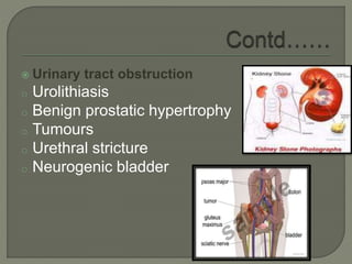  Urinary tract obstruction
o Urolithiasis
o Benign prostatic hypertrophy
o Tumours
o Urethral stricture
o Neurogenic bladder
 