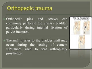 Orthopedic pins and screws can
commonly perforate the urinary bladder,
particularly during internal fixation of
pelvic fractures.
 Thermal injuries to the bladder wall may
occur during the setting of cement
substances used to seat arthroplasty
prosthetics.
 