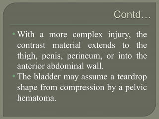 • With a more complex injury, the
contrast material extends to the
thigh, penis, perineum, or into the
anterior abdominal wall.
• The bladder may assume a teardrop
shape from compression by a pelvic
hematoma.
 