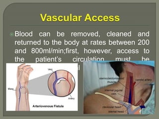 Blood can be removed, cleaned and
returned to the body at rates between 200
and 800ml/min;first, however, access to
the patient’s circulation must be
established. Several kinds of access are
available.
 