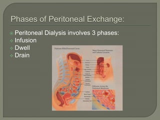 Peritoneal Dialysis involves 3 phases:
 Infusion
 Dwell
 Drain

 