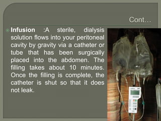  Infusion :A sterile, dialysis
solution flows into your peritoneal
cavity by gravity via a catheter or
tube that has been surgically
placed into the abdomen. The
filling takes about 10 minutes.
Once the filling is complete, the
catheter is shut so that it does
not leak.
 
