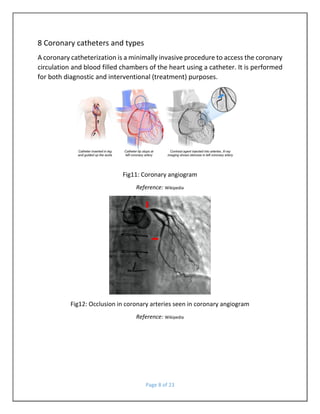 catheters | PDF