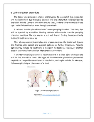 catheters | PDF