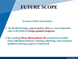 PPT on BRAIN TUMOR detection in MRI images based on IMAGE SEGMENTATION ...