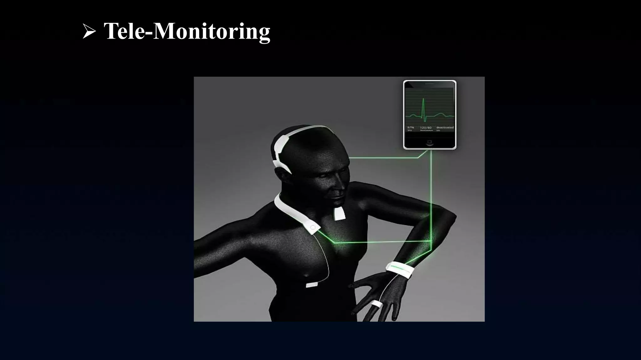  Tele-Monitoring
 