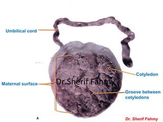 Cotyledon
Groove between
cotyledons
Umbilical cord
Maternal surface
Dr. Sherif Fahmy
Dr.Sherif Fahmy
 