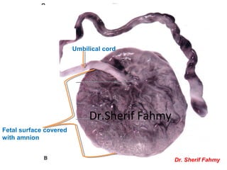Fetal surface covered
with amnion
Umbilical cord
Dr. Sherif Fahmy
Dr.Sherif Fahmy
 
