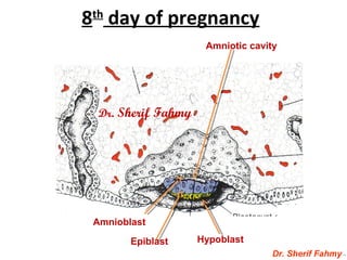 8th
day of pregnancy
Dr. Sherif Fahmy
Amnioblast
Amniotic cavity
Epiblast Hypoblast
Dr. Sherif Fahmy
 