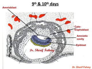9th
& 10th
days
Dr. Sherif Fahmy
Cyto-
trophoblast
Amnioblast
Amniotic
cavity
Epiblast
Dr. Sherif Fahmy
 
