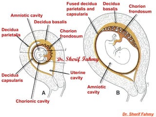 Dr. Sherif Fahmy
Decidua basalis
Decidua
parietalis
Decidua
capsularis
Chorion
frondosum
Uterine
cavity
Amniotic cavity
Chorion
frondosum
Fused decidua
parietalis and
capsularis
Amniotic
cavity
Decidua
basalis
Chorionic cavity
Dr. Sherif Fahmy
 