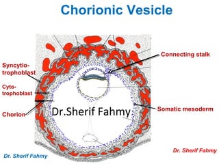 Connecting stalk
Somatic mesoderm
Syncytio-
trophoblast
Cyto-
trophoblast
Chorion
Chorionic Vesicle
Dr. Sherif Fahmy
Dr. Sherif Fahmy
Dr.Sherif Fahmy
 