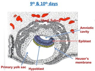 9th
& 10th
days
Primary yolk sac
Heuser’s
membrane
Hypoblast
Amniotic
cavity
Epiblast
Dr. Sherif Fahmy
 