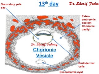 13th
day
Endodermal
cells
Secondary yolk
sac
Exocoelomic cyst
Extra-
embryonic
coelom
Chorionic
cavity)
Dr.Sherif Fahmy
Chorionic
Vesicle
Dr. Sherif Fahmy
 