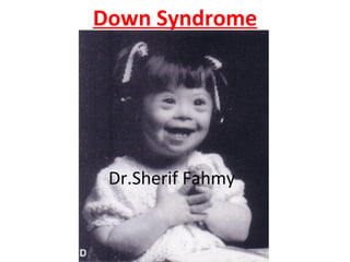 Down Syndrome
Dr.Sherif Fahmy
 
