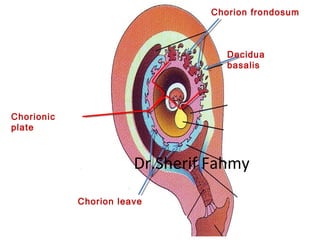 Decidua
basalis
Chorion frondosum
Chorionic
plate
Chorion leave
Dr.Sherif Fahmy
 