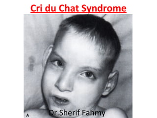 Cri du Chat Syndrome
Dr.Sherif Fahmy
 