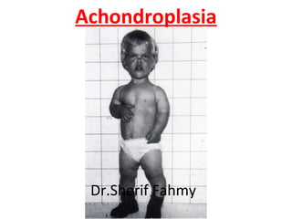 Achondroplasia
Dr.Sherif Fahmy
 