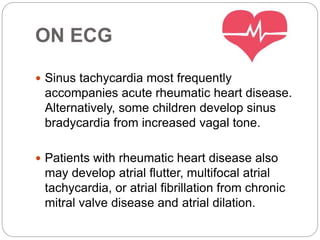 ON ECG
 Sinus tachycardia most frequently
accompanies acute rheumatic heart disease.
Alternatively, some children develop sinus
bradycardia from increased vagal tone.
 Patients with rheumatic heart disease also
may develop atrial flutter, multifocal atrial
tachycardia, or atrial fibrillation from chronic
mitral valve disease and atrial dilation.
 