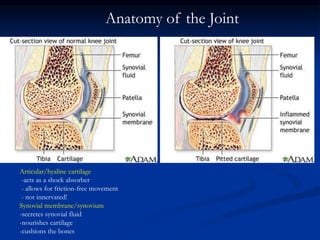 Anatomy of the Joint
Articular/hyaline cartilage
-acts as a shock absorber
- allows for friction-free movement
- not innervated!
Synovial membrane/synovium
-secretes synovial fluid
-nourishes cartilage
-cushions the bones
 