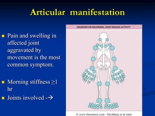 Articular manifestation
 Pain and swelling in
affected joint
aggravated by
movement is the most
common symptom.
 Morning stiffness ≥1
hr
 Joints involved -
 